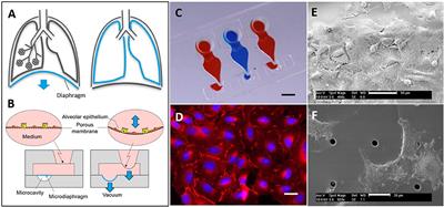 Impaired Wound Healing of Alveolar Lung Epithelial Cells in a Breathing Lung-On-A-Chip